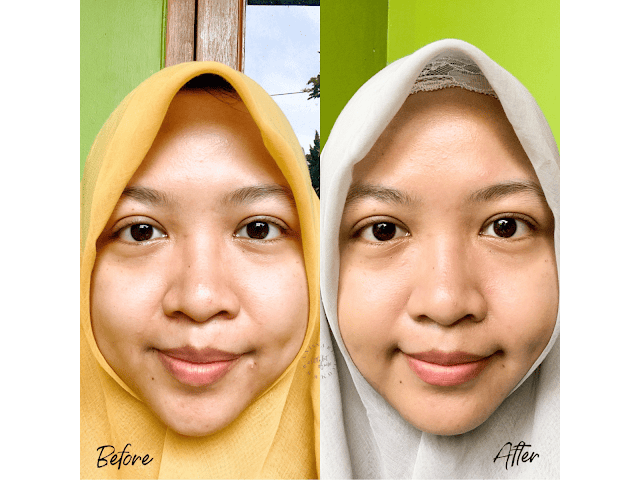 Kulit Sehat dan Cerah dengan Skincare