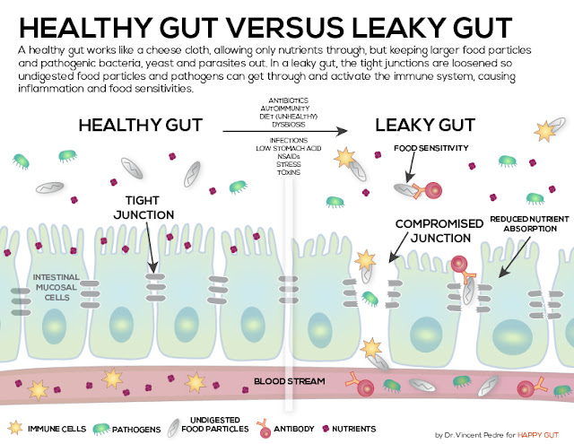 Diet Bebas Gluten